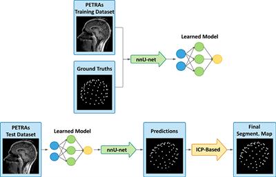 Deep Learning-Based Localization of EEG Electrodes Within MRI Acquisitions